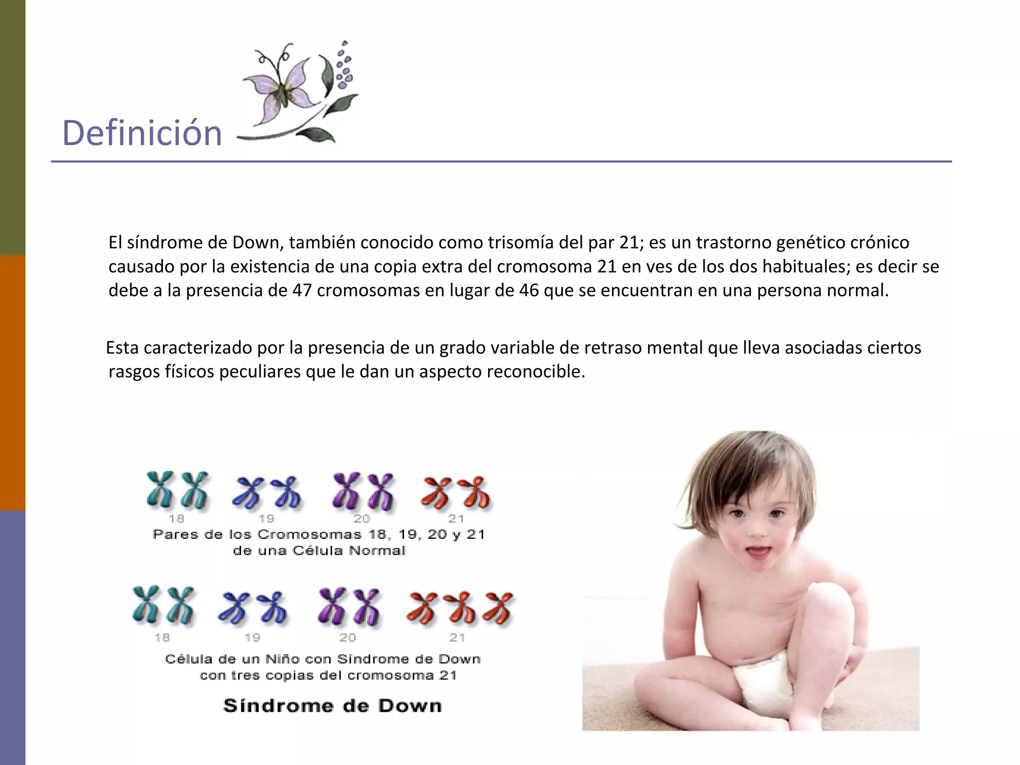 Clasificacin Lluvia Deseo Curiosidades Sobre El Sindrome De Down Codo