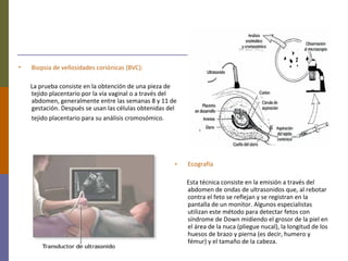 • Biopsia de vellosidades coriónicas (BVC):
La prueba consiste en la obtención de una pieza de
tejido placentario por la vía vaginal o a través del
abdomen, generalmente entre las semanas 8 y 11 de
gestación. Después se usan las células obtenidas del
tejido placentario para su análisis cromosómico.
• Ecografía
Esta técnica consiste en la emisión a través del
abdomen de ondas de ultrasonidos que, al rebotar
contra el feto se reflejan y se registran en la
pantalla de un monitor. Algunos especialistas
utilizan este método para detectar fetos con
síndrome de Down midiendo el grosor de la piel en
el área de la nuca (pliegue nucal), la longitud de los
huesos de brazo y pierna (es decir, humero y
fémur) y el tamaño de la cabeza.
 