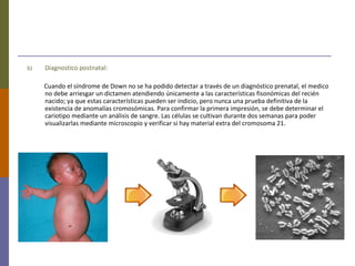 b) Diagnostico postnatal:
Cuando el síndrome de Down no se ha podido detectar a través de un diagnóstico prenatal, el medico
no debe arriesgar un dictamen atendiendo únicamente a las características fisonómicas del recién
nacido; ya que estas características pueden ser indicio, pero nunca una prueba definitiva de la
existencia de anomalías cromosómicas. Para confirmar la primera impresión, se debe determinar el
cariotipo mediante un análisis de sangre. Las células se cultivan durante dos semanas para poder
visualizarlas mediante microscopio y verificar si hay material extra del cromosoma 21.
 
