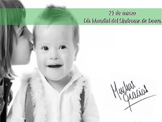 Síndrome de Down