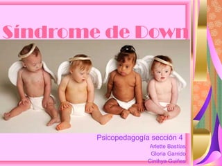 Síndrome de Down
Psicopedagogía sección 4
Arlette Bastías
Gloria Garrido
Cinthya Guiñes
 
