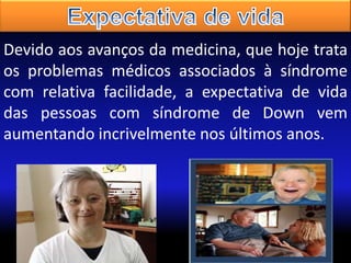 Devido aos avanços da medicina, que hoje trata
os problemas médicos associados à síndrome
com relativa facilidade, a expectativa de vida
das pessoas com síndrome de Down vem
aumentando incrivelmente nos últimos anos.

 
