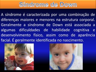 A síndrome é caracterizada por uma combinação de
diferenças maiores e menores na estrutura corporal.
Geralmente a síndrome de Down está associada a
algumas dificuldades de habilidade cognitiva e
desenvolvimento físico, assim como de aparência
facial. É geralmente identificada no nascimento.

 