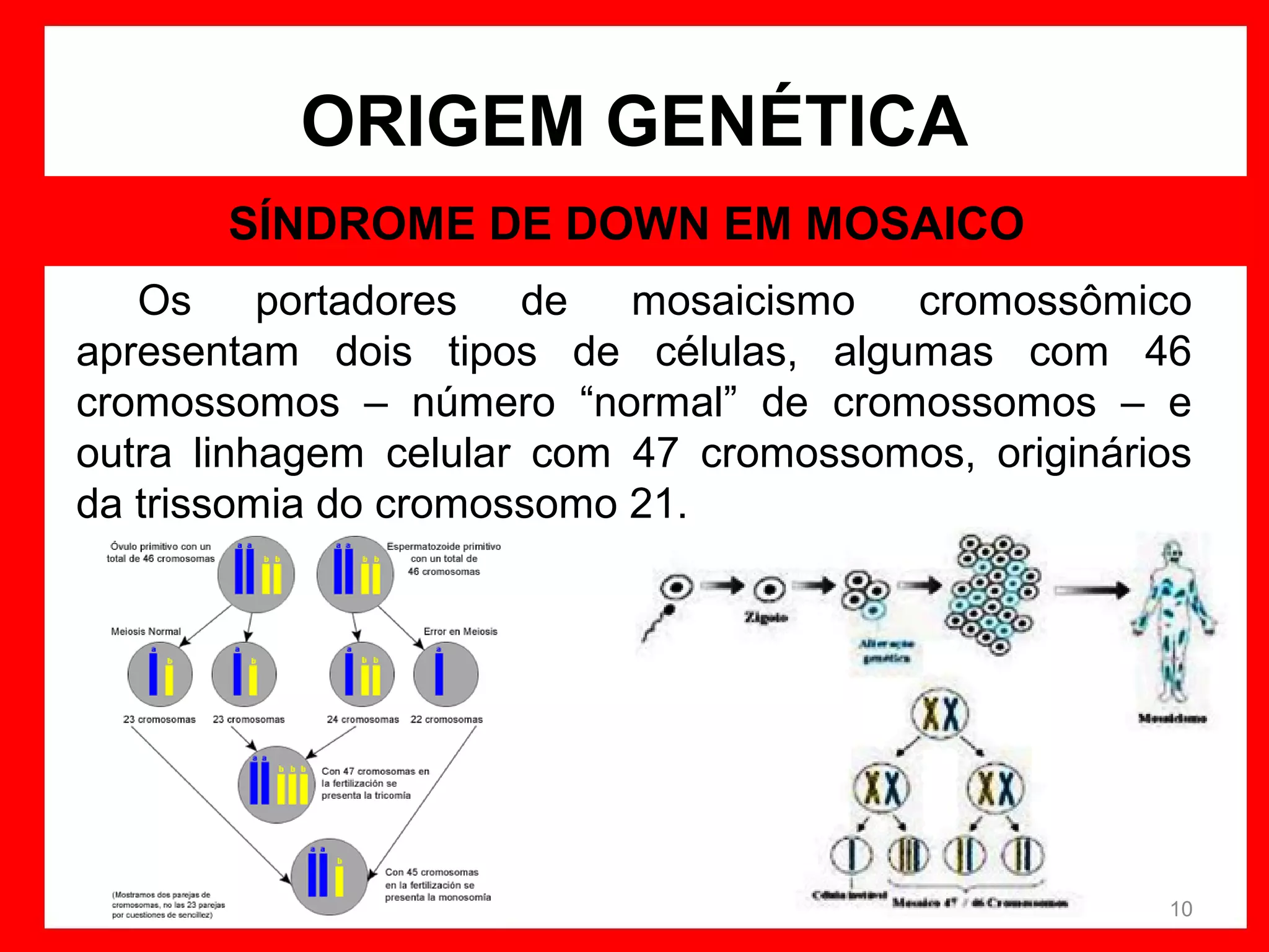 ORIGEM GENÉTICA
SÍNDROME DE DOWN EM MOSAICO
Os
portadores
de
mosaicismo
cromossômico
apresentam dois tipos de células, algumas com 46
cromossomos – número “normal” de cromossomos – e
outra linhagem celular com 47 cromossomos, originários
da trissomia do cromossomo 21.

10

 