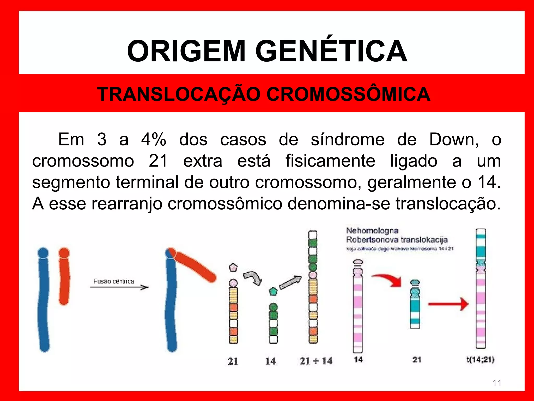 ORIGEM GENÉTICA
TRANSLOCAÇÃO CROMOSSÔMICA
Em 3 a 4% dos casos de síndrome de Down, o
cromossomo 21 extra está fisicamente ligado a um
segmento terminal de outro cromossomo, geralmente o 14.
A esse rearranjo cromossômico denomina-se translocação.

11

 