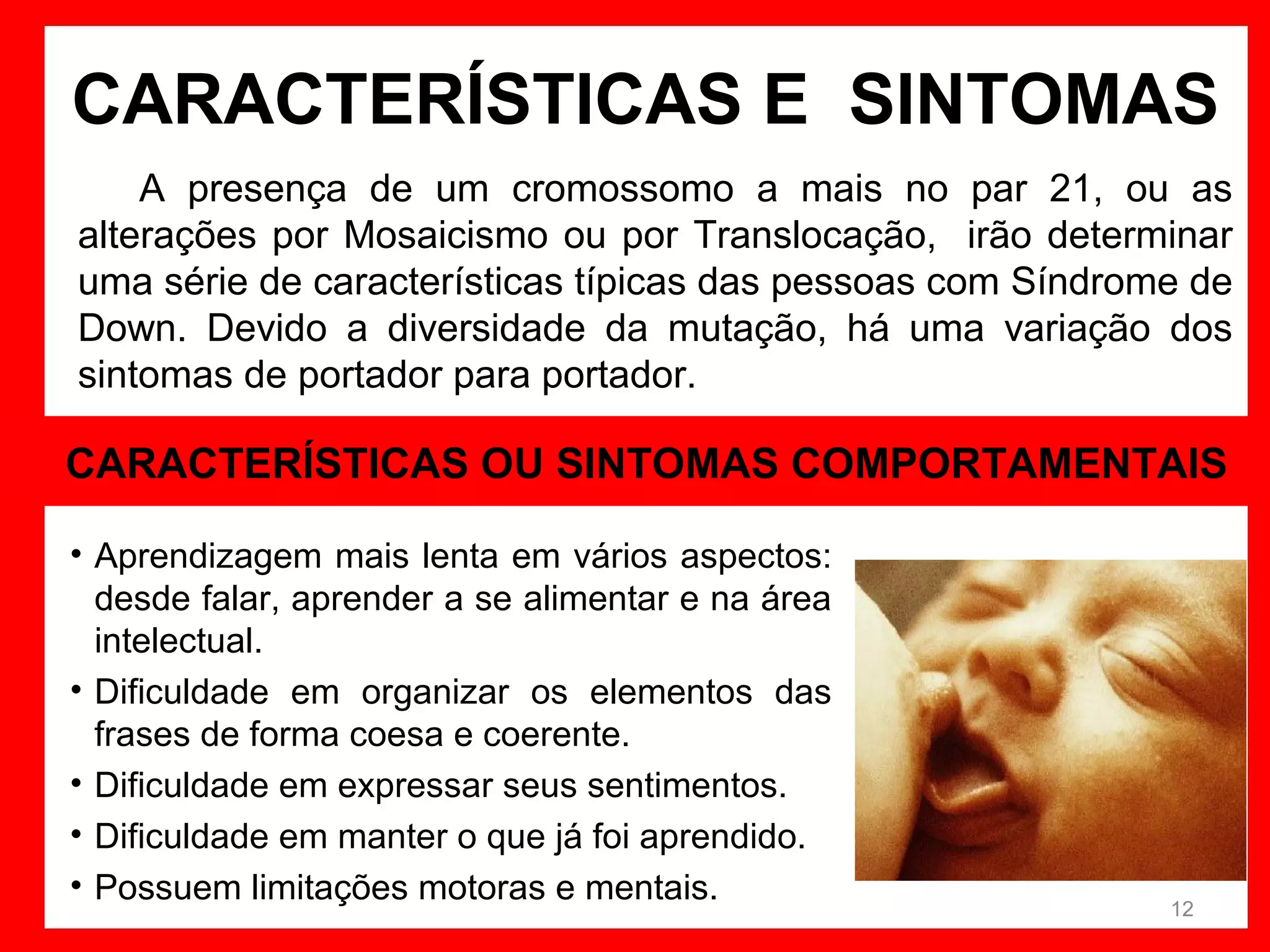 CARACTERÍSTICAS E SINTOMAS
A presença de um cromossomo a mais no par 21, ou as
alterações por Mosaicismo ou por Translocação, irão determinar
uma série de características típicas das pessoas com Síndrome de
Down. Devido a diversidade da mutação, há uma variação dos
sintomas de portador para portador.

CARACTERÍSTICAS OU SINTOMAS COMPORTAMENTAIS
• Aprendizagem mais lenta em vários aspectos:
desde falar, aprender a se alimentar e na área
intelectual.
• Dificuldade em organizar os elementos das
frases de forma coesa e coerente.
• Dificuldade em expressar seus sentimentos.
• Dificuldade em manter o que já foi aprendido.
• Possuem limitações motoras e mentais.

12

 