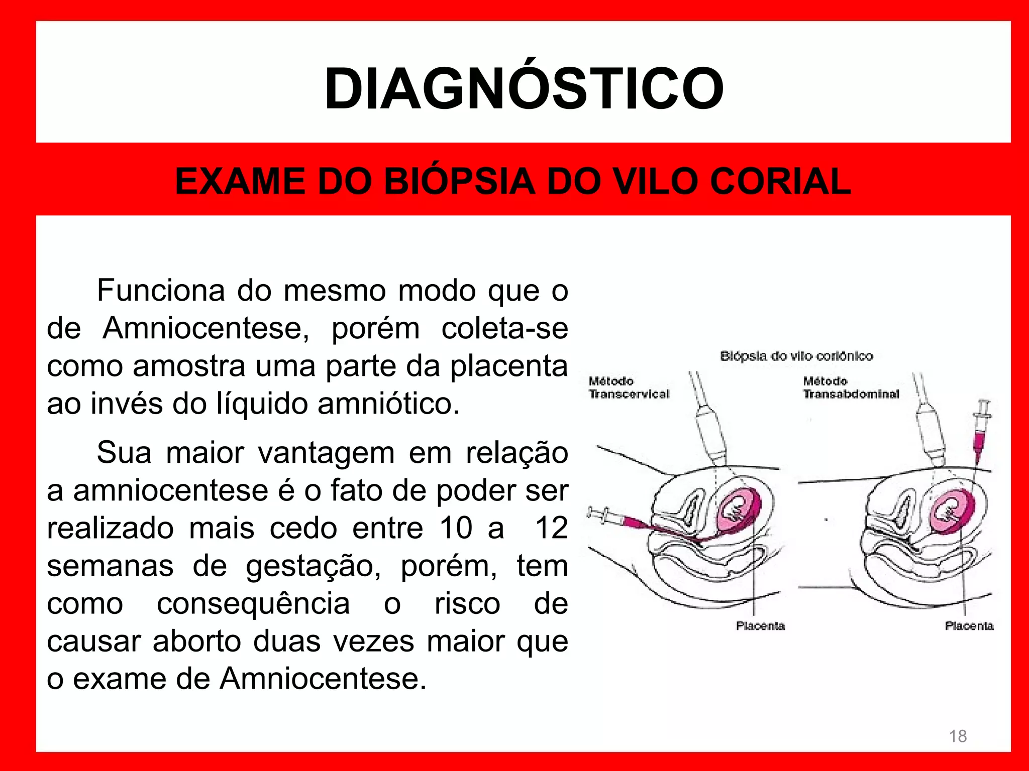 DIAGNÓSTICO
EXAME DO BIÓPSIA DO VILO CORIAL
Funciona do mesmo modo que o
de Amniocentese, porém coleta-se
como amostra uma parte da placenta
ao invés do líquido amniótico.
Sua maior vantagem em relação
a amniocentese é o fato de poder ser
realizado mais cedo entre 10 a 12
semanas de gestação, porém, tem
como consequência o risco de
causar aborto duas vezes maior que
o exame de Amniocentese.
18

 