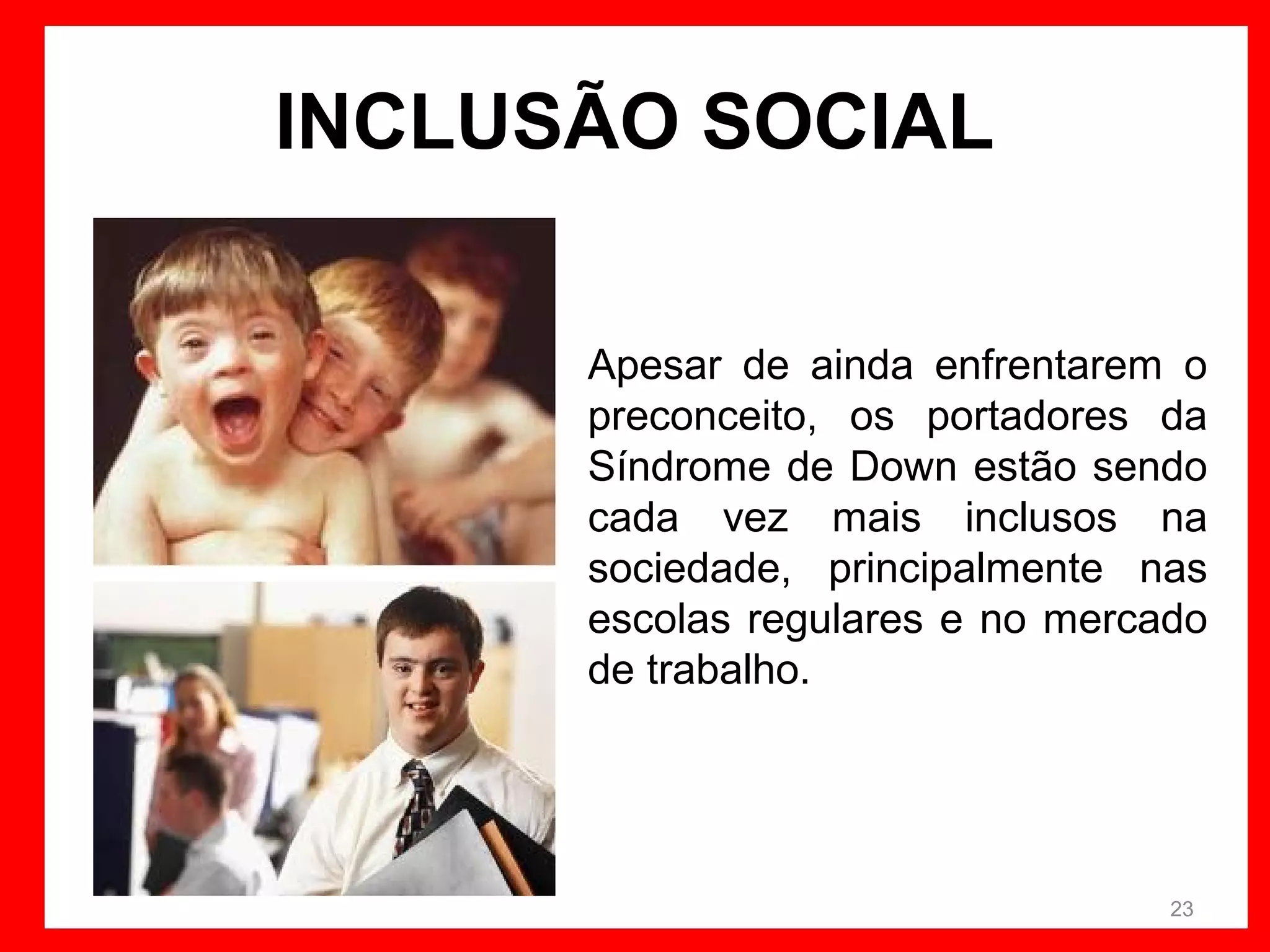 INCLUSÃO SOCIAL
Apesar de ainda enfrentarem o
preconceito, os portadores da
Síndrome de Down estão sendo
cada vez mais inclusos na
sociedade, principalmente nas
escolas regulares e no mercado
de trabalho.

23

 