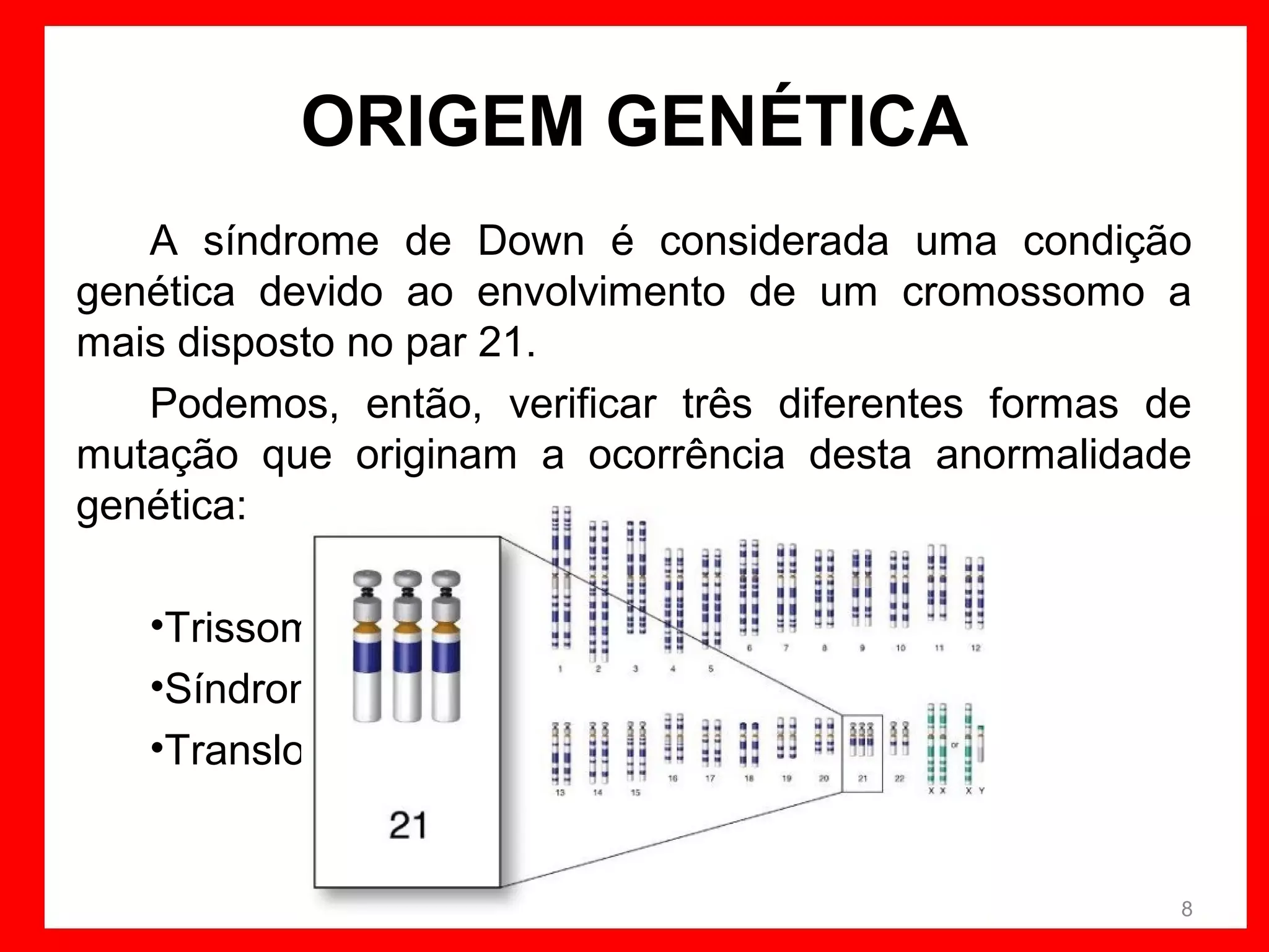 ORIGEM GENÉTICA
A síndrome de Down é considerada uma condição
genética devido ao envolvimento de um cromossomo a
mais disposto no par 21.
Podemos, então, verificar três diferentes formas de
mutação que originam a ocorrência desta anormalidade
genética:
•Trissomia Livre do cromossomo 21
•Síndrome de Down em mosaico
•Translocação Robertsoniana

8

 