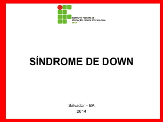 SÍNDROME DE DOWN

Salvador – BA
2014

 