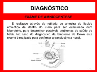 DIAGNÓSTICO
EXAME DE AMNIOCENTESE
É realizado através da retirada de amostra do líquido
amniótico de dentro do útero para ser examinado num
laboratório, para determinar possíveis problemas de saúde do
bebê. No caso do diagnostico da Síndrome de Down este
exame é realizado para confirmar a translucência nucal.

17

 