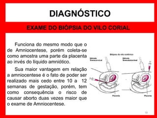 DIAGNÓSTICO
EXAME DO BIÓPSIA DO VILO CORIAL
Funciona do mesmo modo que o
de Amniocentese, porém coleta-se
como amostra uma parte da placenta
ao invés do líquido amniótico.
Sua maior vantagem em relação
a amniocentese é o fato de poder ser
realizado mais cedo entre 10 a 12
semanas de gestação, porém, tem
como consequência o risco de
causar aborto duas vezes maior que
o exame de Amniocentese.
18

 