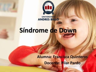 Síndrome de Down
Alumna: Francisca Quinteros
Docente: Pilar Pardo
 