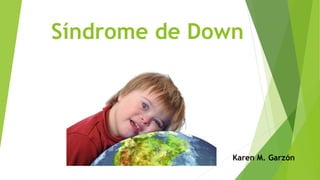 Síndrome de Down 
Karen M. Garzón 
 