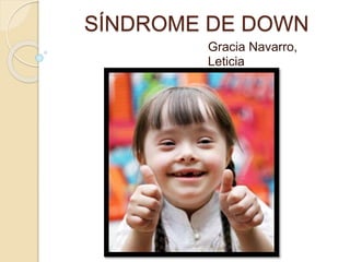SÍNDROME DE DOWN
Gracia Navarro,
Leticia
 