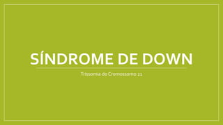 SÍNDROME DE DOWN
Trissomia do Cromossomo 21
 