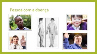 Pessoa com a doença
 
