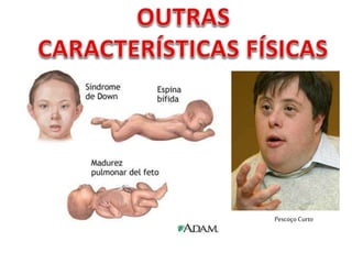 Pescoço Curto
 