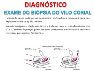 Funciona do mesmo modo que o de Amniocentese, porém coleta-se como amostra uma parte
da placenta ao invés do líquido amniótico.
Sua maior vantagem em relação a amniocentese é o fato de poder ser realizado mais cedo entre
10 a 12 semanas de gestação, porém, tem como consequência o risco de causar aborto duas
vezes maior que o exame de Amniocentese.
 