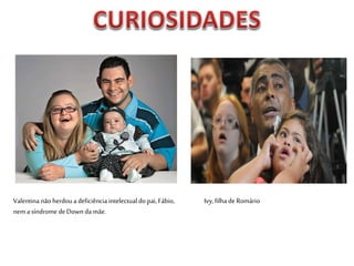 Valentina não herdou a deficiência intelectual do pai, Fábio,
nem a síndrome deDown da mãe.
Ivy,filha de Romário
 