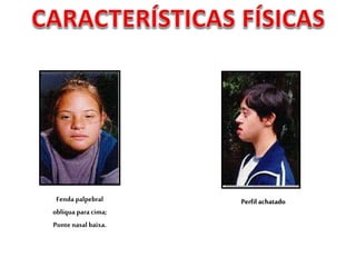 Fenda palpebral
oblíqua para cima;
Ponte nasal baixa.
Perfil achatado
 