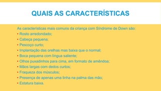 QUAIS AS CARACTERÍSTICAS
As características mais comuns da criança com Síndrome de Down são:
• Rosto arredondado;
• Cabeça pequena;
• Pescoço curto;
• Implantação das orelhas mas baixa que o normal;
• Boca pequena com língua saliente;
• Olhos puxadinhos para cima, em formato de amêndoa;
• Mãos largas com dedos curtos;
• Fraqueza dos músculos;
• Presença de apenas uma linha na palma das mão;
• Estatura baixa.
 