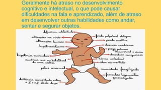 Geralmente há atraso no desenvolvimento
cognitivo e intelectual, o que pode causar
dificuldades na fala e aprendizado, além de atraso
em desenvolver outras habilidades como andar,
sentar e segurar objetos.
 