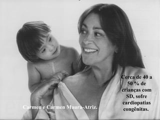 Carmen e Carmen Maura-Atriz. Cerca de 40 a 50 % de crianças com SD, sofre cardiopatias congênitas.   