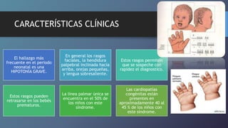CARACTERÍSTICAS CLÍNICAS
El hallazgo más
frecuente en el periodo
neonatal es una
HIPOTONÍA GRAVE.
En general los rasgos
faciales, la hendidura
palpebral inclinada hacia
arriba, orejas pequeñas,
y lengua sobresaliente.
Estos rasgos permiten
que se sospeche con
rapidez el diagnostico.
Estos rasgos pueden
retrasarse en los bebés
prematuros.
La línea palmar única se
encuentra en el 50% de
los niños con este
síndrome.
Las cardiopatías
congénitas están
presentes en
aproximadamente 40 al
45 % de los niños con
este síndrome.
 