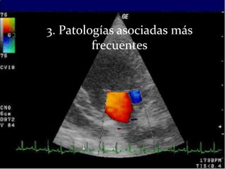 3. Patologías asociadas más
         frecuentes
 