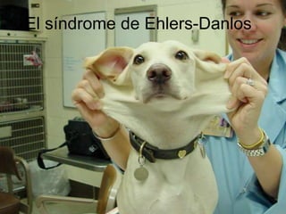 El síndrome de Ehlers-Danlos
 