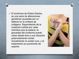 O El síndrome de Ehlers-Danlos,
  es una serie de alteraciones
  genéticas causadas por un
  defecto en la síntesis de
  colágeno. Dependiendo de la
  mutación sufrida por cada
  individuo que la padece, la
  gravedad del síndrome puede
  variar desde leve a una situación
  potencialmente mortal.
  Actualmente no existe cura, y el
  tratamiento es puramente de
  soporte.
 