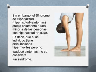 Sin embargo, el Síndrome
de Hiperlaxitud
(hiperlaxitud+síntomas)
afecta solamente a una
minoría de las personas
con hiperlaxitud articular.
Es decir, que si un
individuo tiene
articulaciones
hipermoviles pero no
 padece síntomas, no se
considera
 un síndrome.
 