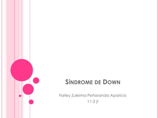 Síndrome de Down Farley Zuleima Peñaranda Aparicio 11-2 jt 