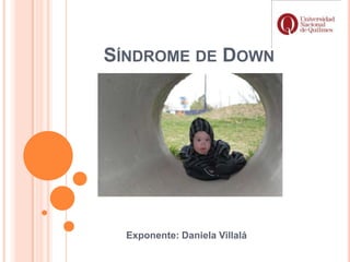 SÍNDROME DE DOWN




  Exponente: Daniela Villalá
 