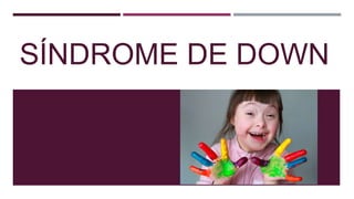 SÍNDROME DE DOWN
 