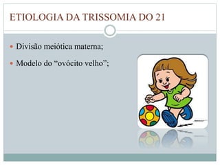 ETIOLOGIA DA TRISSOMIA DO 21 
 Divisão meiótica materna; 
 Modelo do “ovócito velho”; 
 