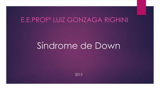 Síndrome de Down
2015
E.E.PROFº LUIZ GONZAGA RIGHINI
 
