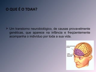 O QUE É O TDAH?



 Um transtorno neurobiológico, de causas provavelmente
  genéticas, que aparece na infância e freqüentemente
  acompanha o indivíduo por toda a sua vida.
 