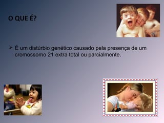 O QUE É?


 É um distúrbio genético causado pela presença de um
  cromossomo 21 extra total ou parcialmente.
 
 