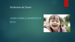 Síndrome de Down
JUAN CAMILO BARRIOS B
2015
 