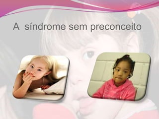 Ponte nasal achatada;