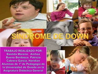Síndrome de down power point