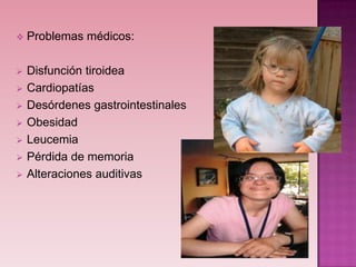    Problemas médicos:

   Disfunción tiroidea
   Cardiopatías
   Desórdenes gastrointestinales
   Obesidad
   Leucemia
   Pérdida de memoria
   Alteraciones auditivas
 