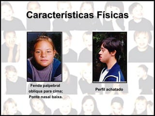 Características FísicasCaracterísticas Físicas
Fenda palpebral
oblíqua para cima;
Ponte nasal baixa.
Perfil achatadoPerfil achatado
 