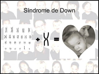 Síndrome de Down
 