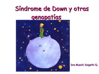 Síndrome de Down y otras  genopatías Dra Muschi Szigethi Q. 