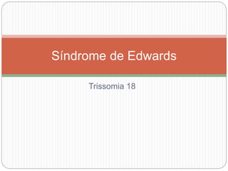 Trissomia 18
Síndrome de Edwards
 