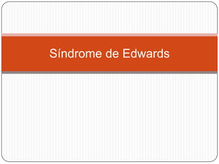 Síndrome de Edwards
 