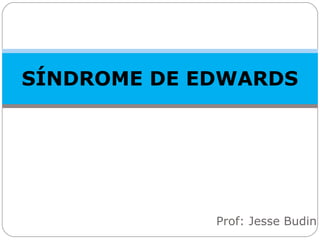 SÍNDROME DE EDWARDS
Prof: Jesse Budin
 
